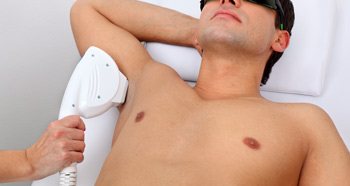 Man getting laser hair removal on his armpits