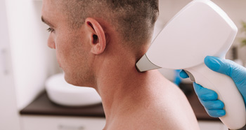 Man getting laser hair removal on his neck