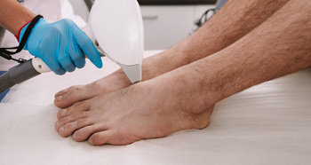 Man getting laser hair removal on his feet